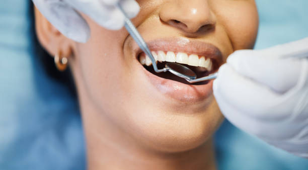Best Emergency Tooth Extraction in Kettering, OH