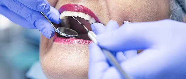 Best Emergency Treatment for Toothache in Kettering, OH